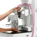 Dłonie ustawiają przystawkę biopsyjną w mammografie Planmed Clarity