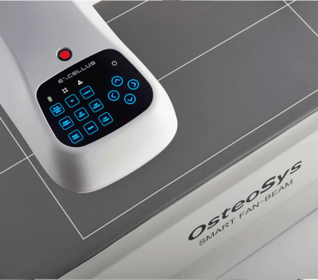 Panel sterowania densytometru OsteoSys Smart Fan Beam w zbliżeniu