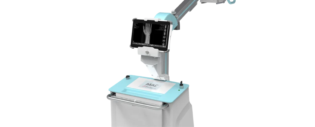 Mobilny aparat RTG GMM MAC Revolution z obrazem RTG na monitorze
