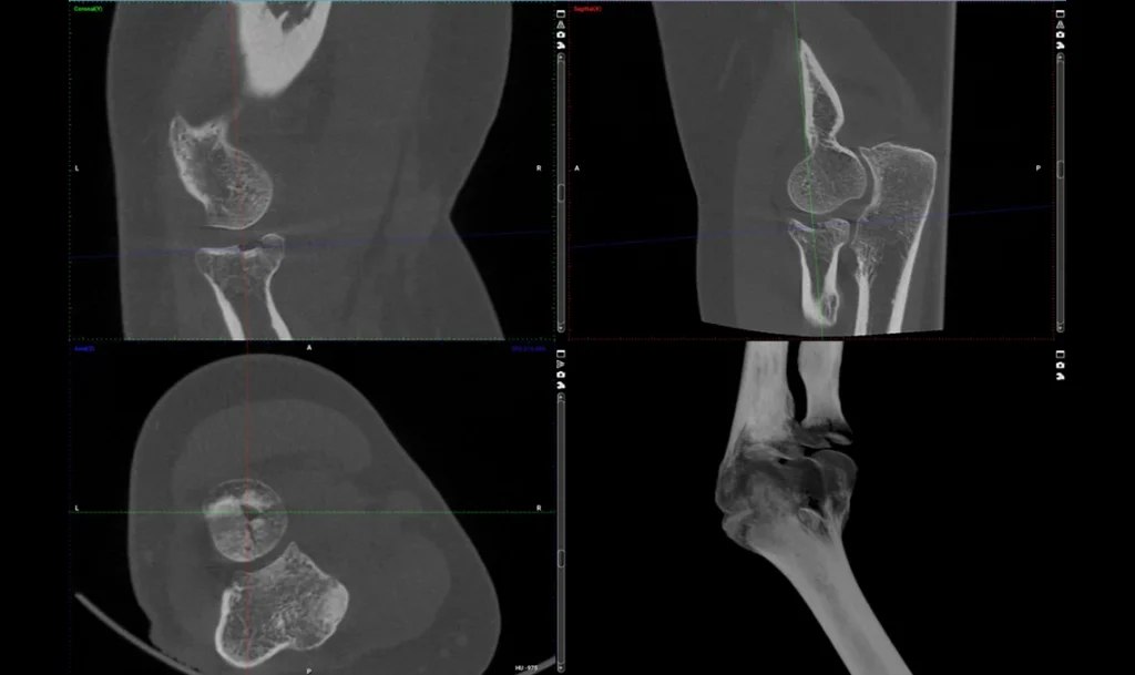 Przekroje tomografii stawu kończyny w kilku projekcjach