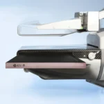 Detektor DRTECH Rose M w ramieniu mammografu analogowego